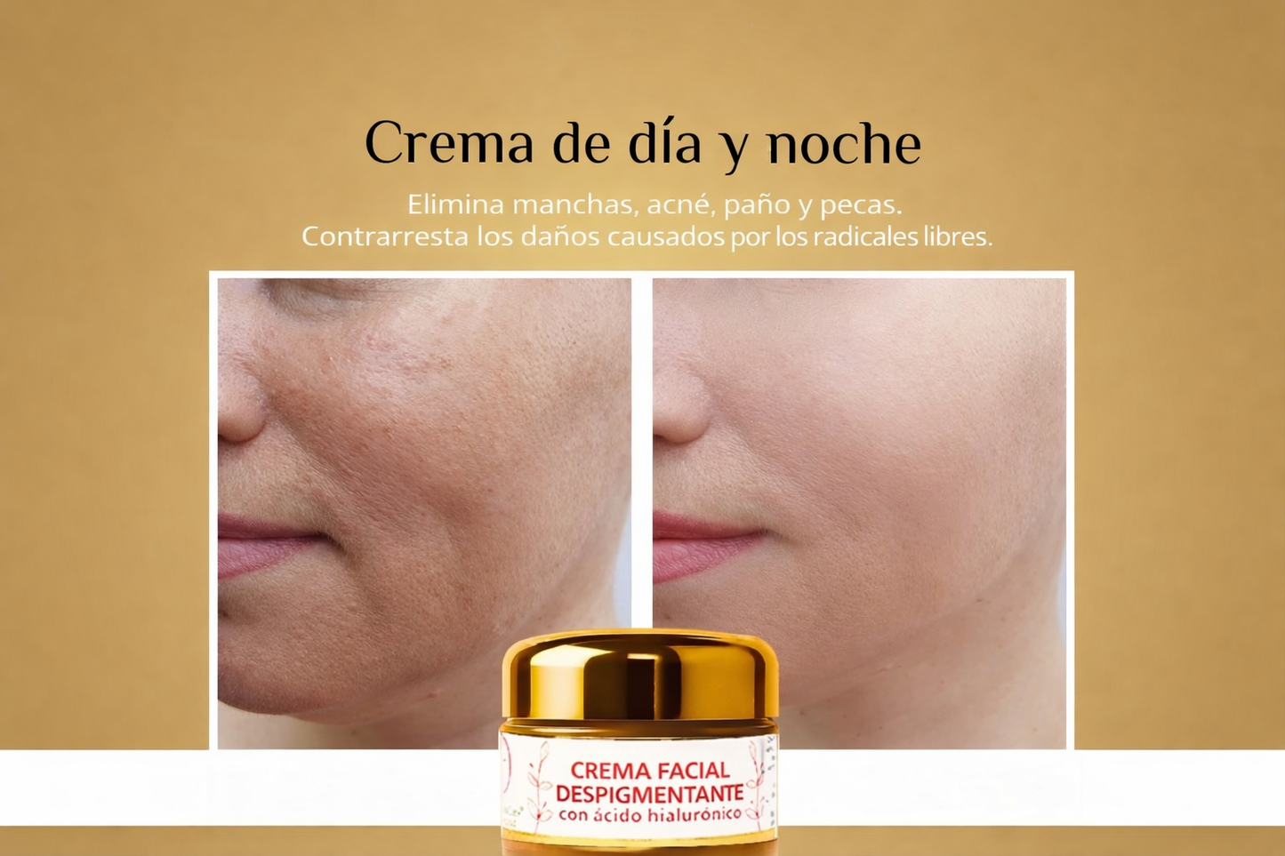 CREMA FACIAL DESPIGMENTANTE con ácido hialurónico