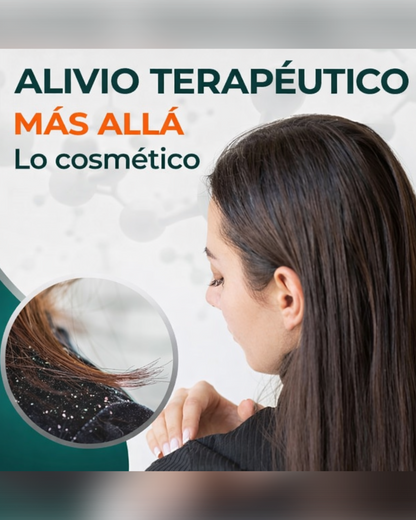 Medicasp Shampoo Anticaspa - Ayuda en la eliminación del hongo de la caspa