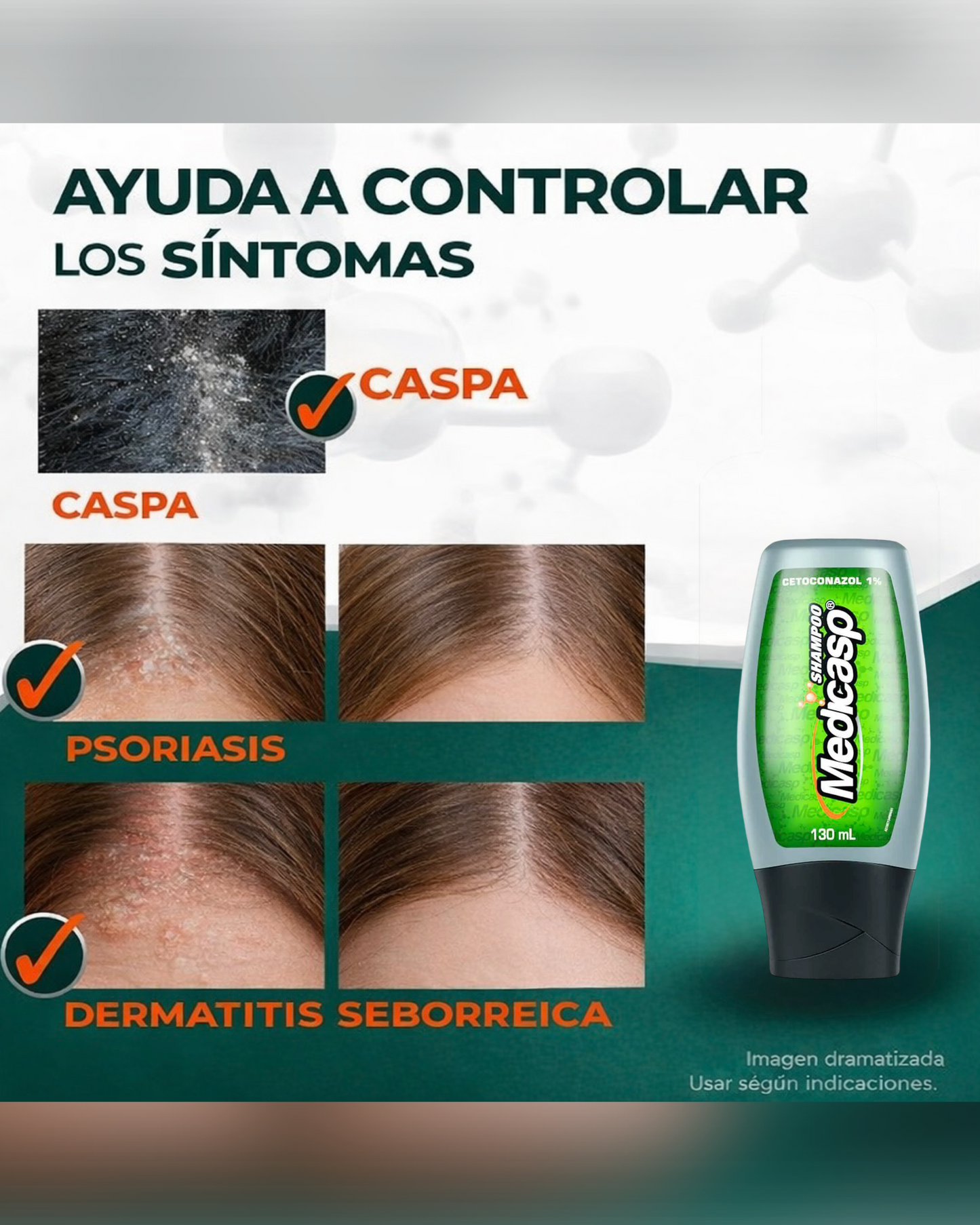 Medicasp Shampoo Anticaspa - Ayuda en la eliminación del hongo de la caspa