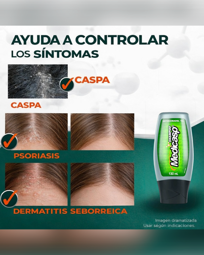 Medicasp Shampoo Anticaspa - Ayuda en la eliminación del hongo de la caspa